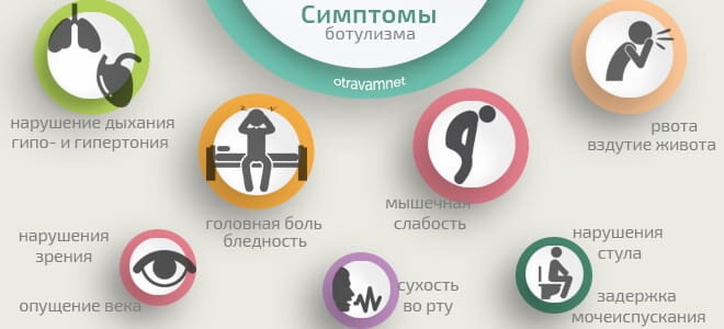СИМПТОМЫ БОТУЛИЗМА.